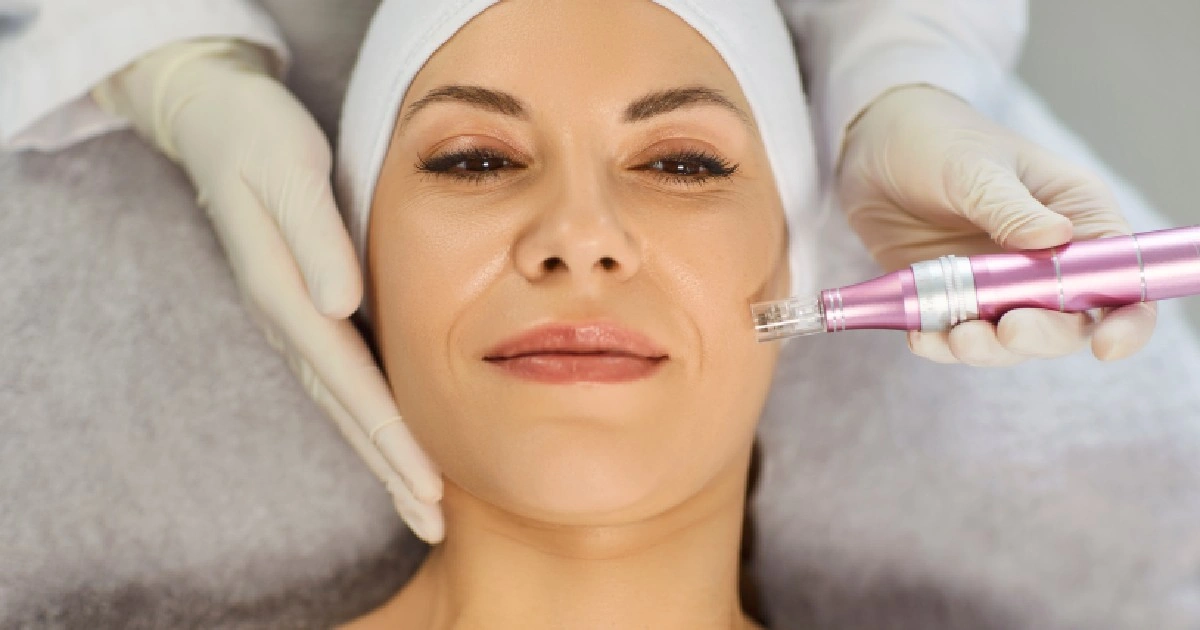 Women receiving Microneedling in Portsmouth, NH