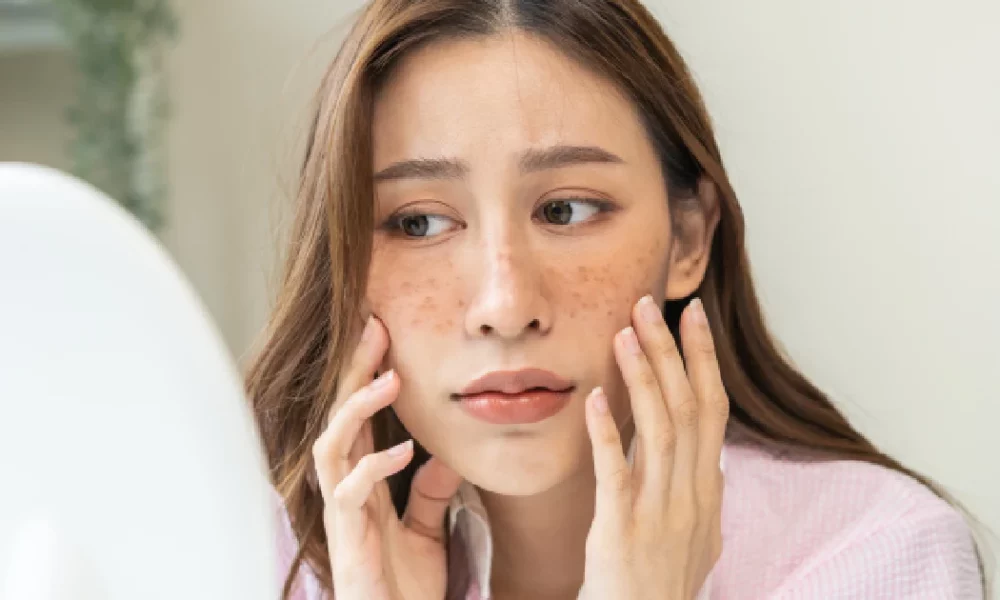 Women need effective acne treatment in Portsmouth, NH