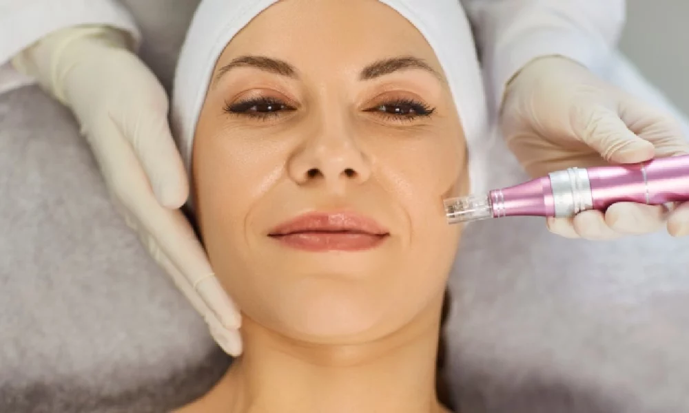 Women receiving Microneedling in Portsmouth, NH